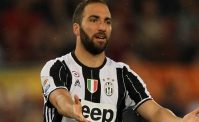 FOTO - Immagine impietosa, Forgione demolisce Higuain: Poverino, non solo crisi tricologica